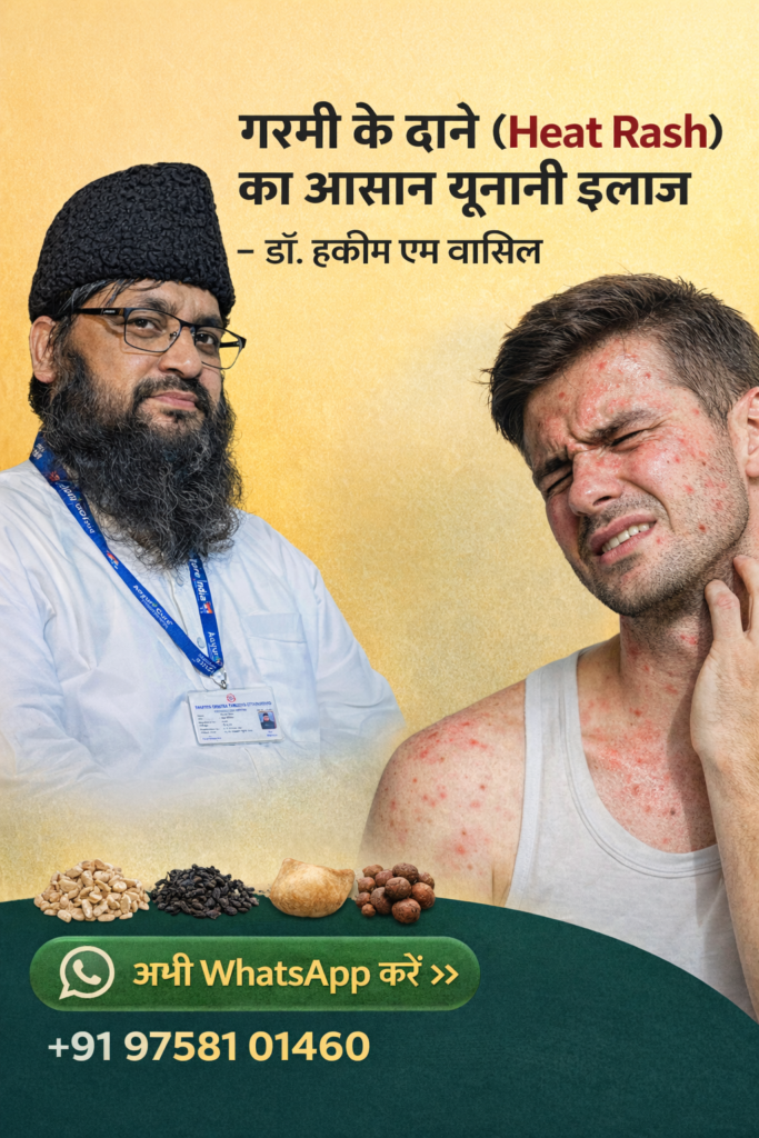 Heat rash treatment by Dr Hakim M Wasil Unani medicine